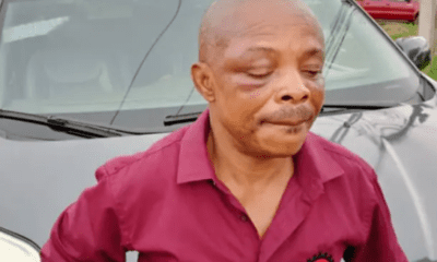 Brutalised NLC President, Ajaero rushed to Owerri FMC