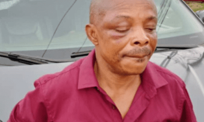 Imo Attack: Ajaero in hospital, battles to save right eye