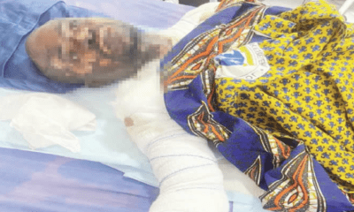 Woman arrested for bathing husband with hot water over wedding attendance